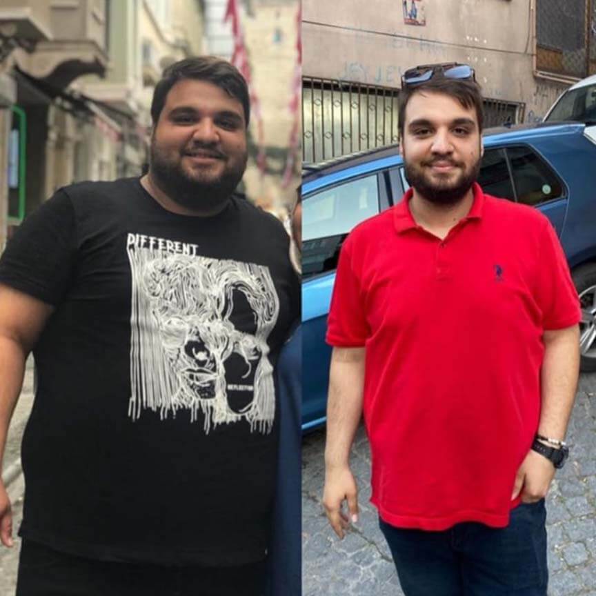 Transit Bipartition In T rkiye A Surgical Approach To Address Obesity personal-training-on-instagram-body-fat-percentage-by-fittrainers